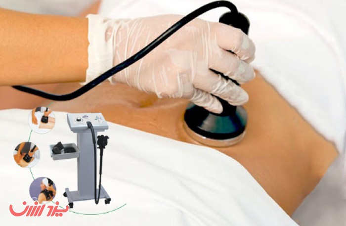 لاغری با دستگاه جی فایو مخصوص بانوان در یزد ارزان